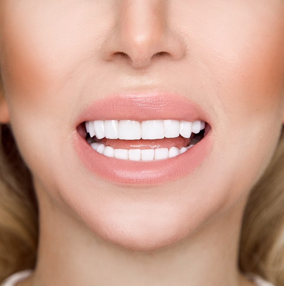 Abbotsford Porcelain Veneers | Family and General Dentist | Abbotsford, BC