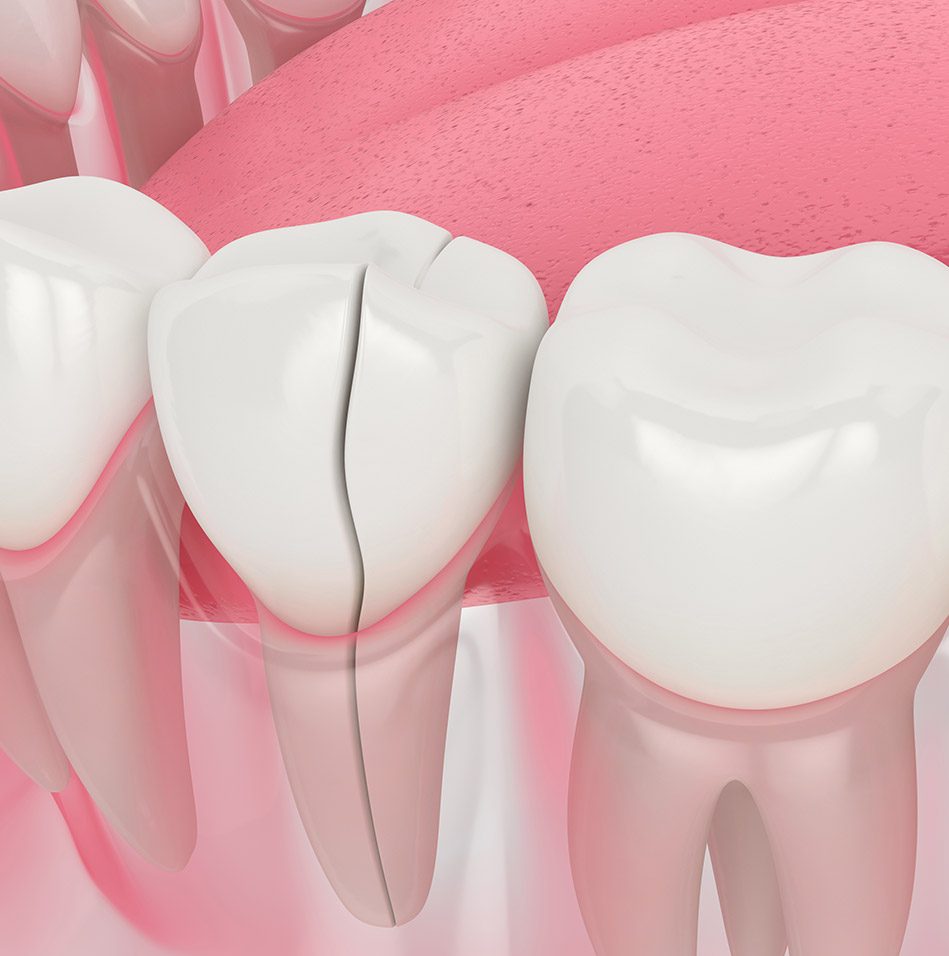 Restorative Dentistry Services | East Abbotsford Dental | General Dentist | Abbotsford, BC