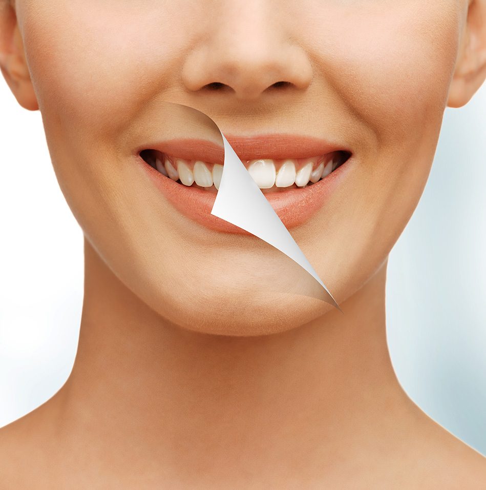 What is cosmetic dentistry | East Abbotsford Dental | Abbotsford, BC